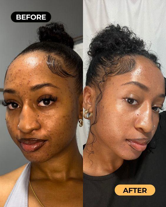 Duo Perfect Skin