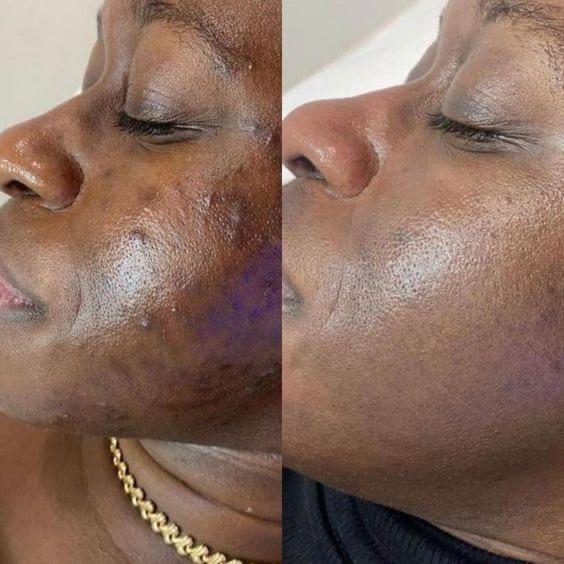 Duo Perfect Skin